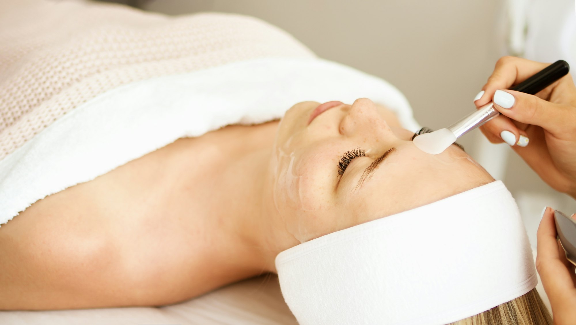 Chemical Peel