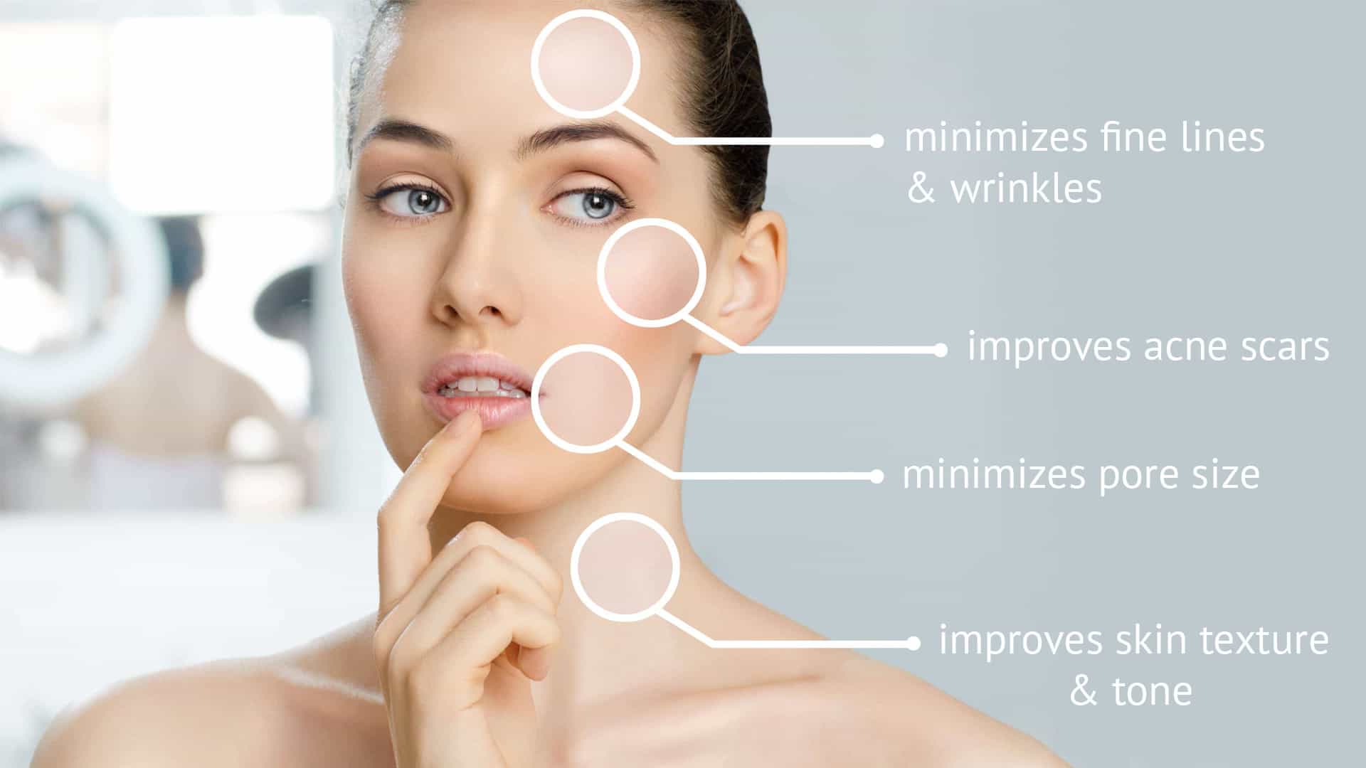Mesotheraphy/Microneedling